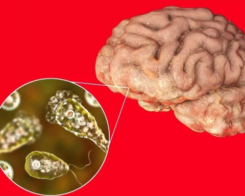 brain eating
